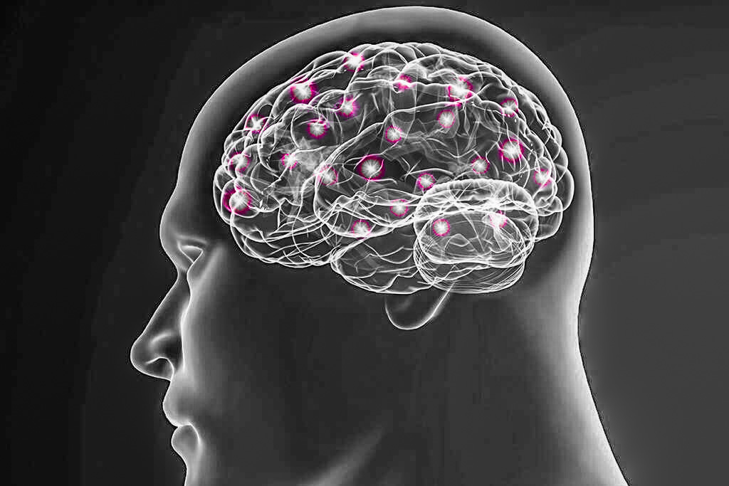 Everything About Capgras Syndrome Symptoms, Causes, and Treatment