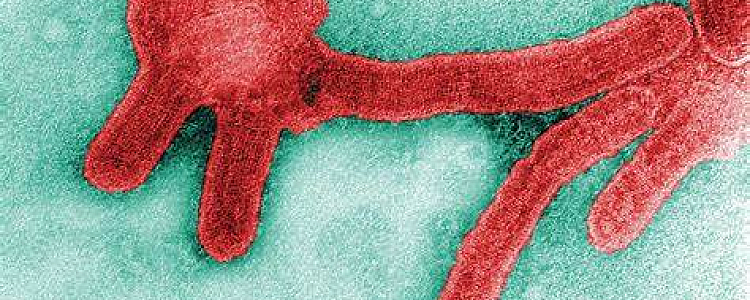 Marburg Virus - A New Pandemic to Wreak Havoc in The World is on Its Way