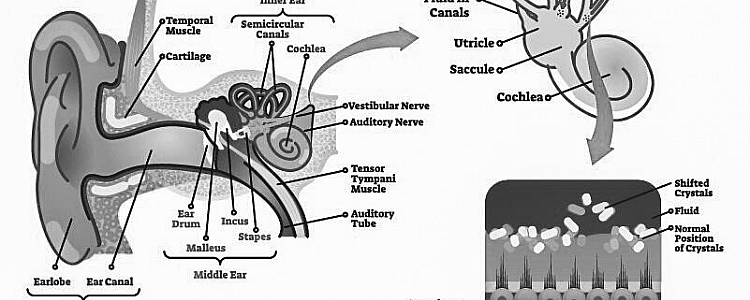 Vertigo: Types, Causes, Symptoms, Diagnosis, Treatment & FAQ